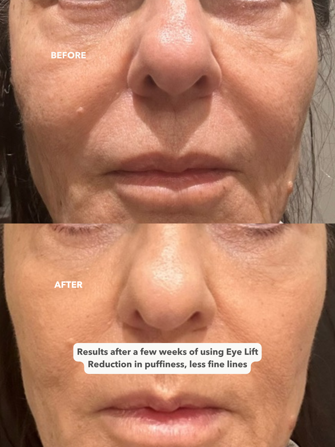 EYE LIFT™ - Firming and Smoothing Eye Cream