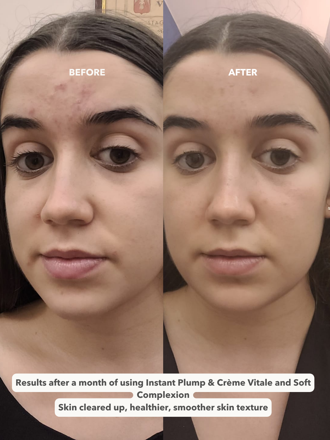 CRÈME VITALE™ - Ultimate Revitalizing Day Cream