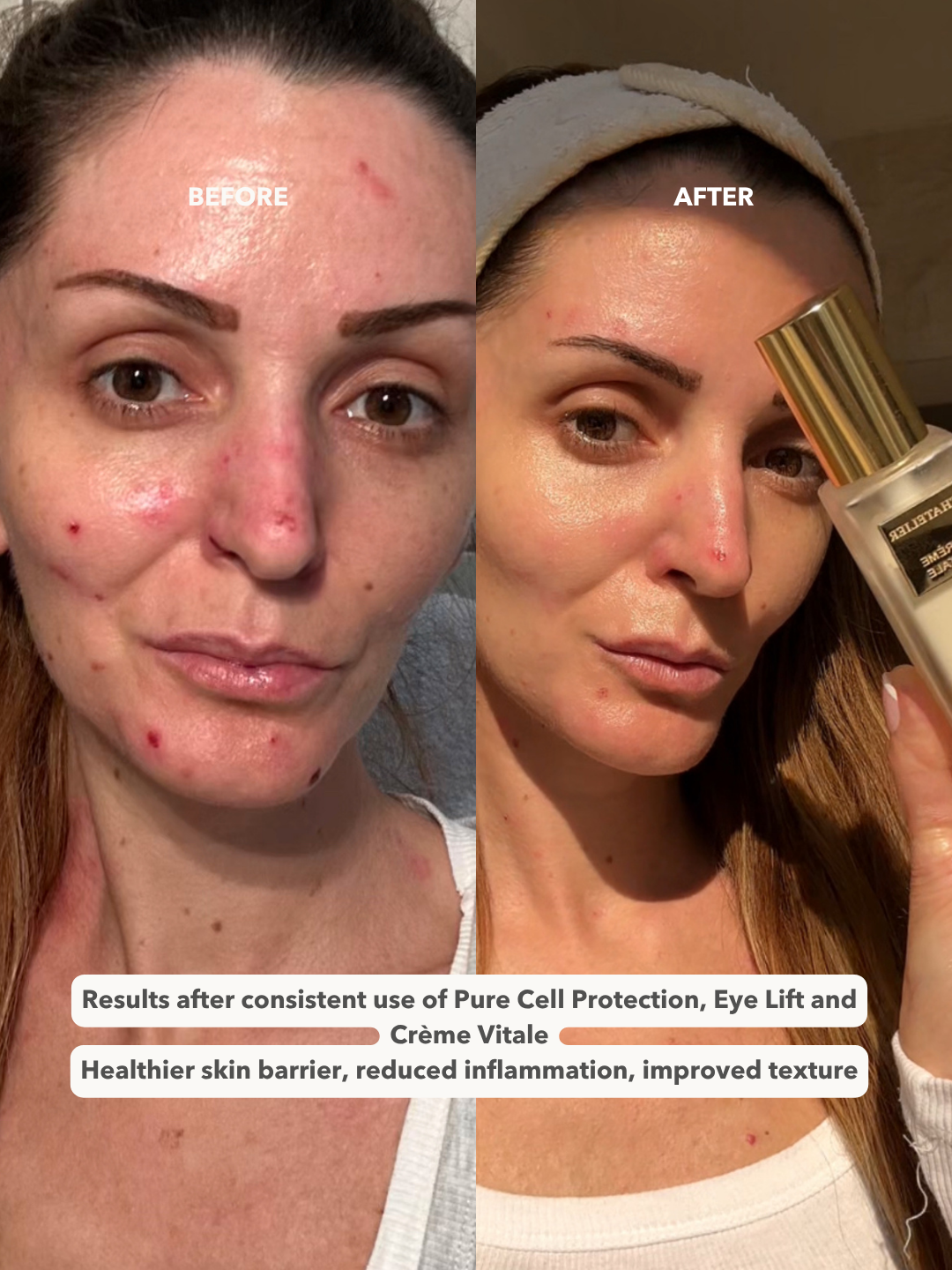 CRÈME VITALE™ - Ultimate Revitalizing Day Cream