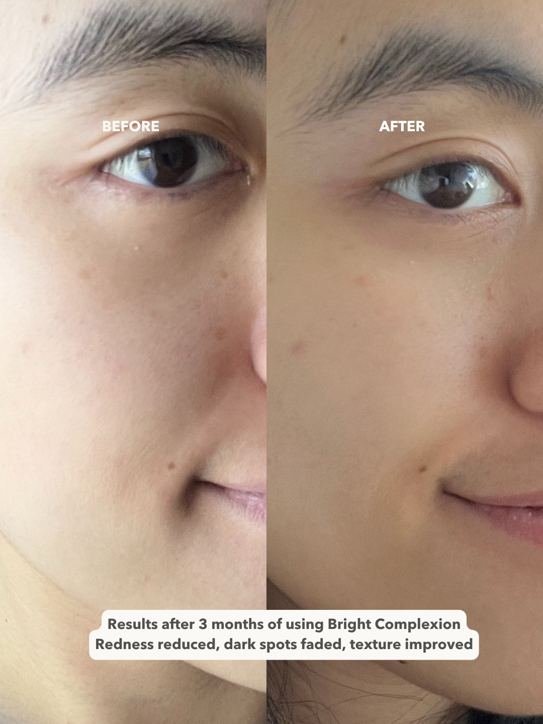 BRIGHT COMPLEXION™ - Ultra Rich Radiance Serum