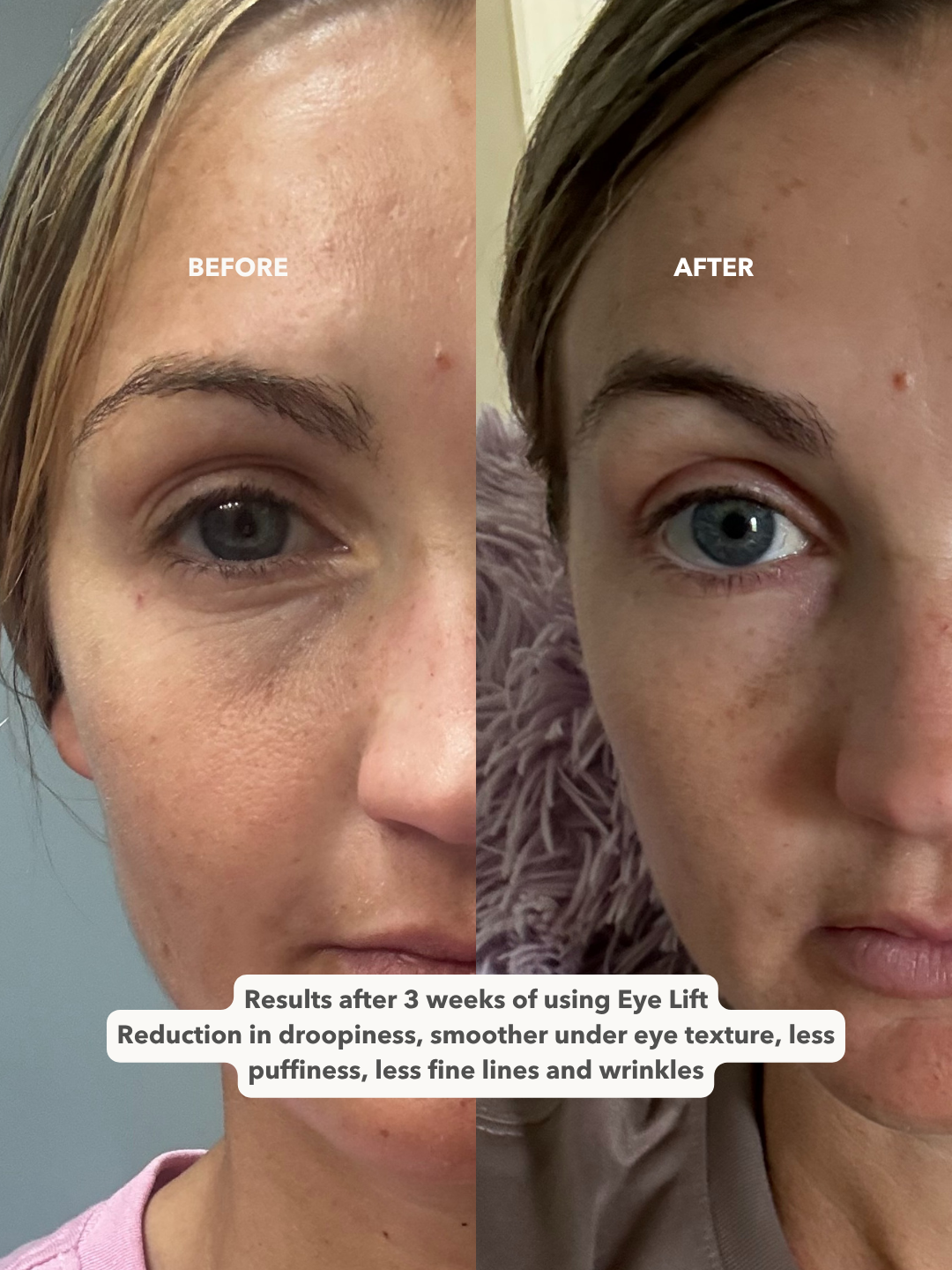 EYE LIFT™ - Firming and Smoothing Eye Cream