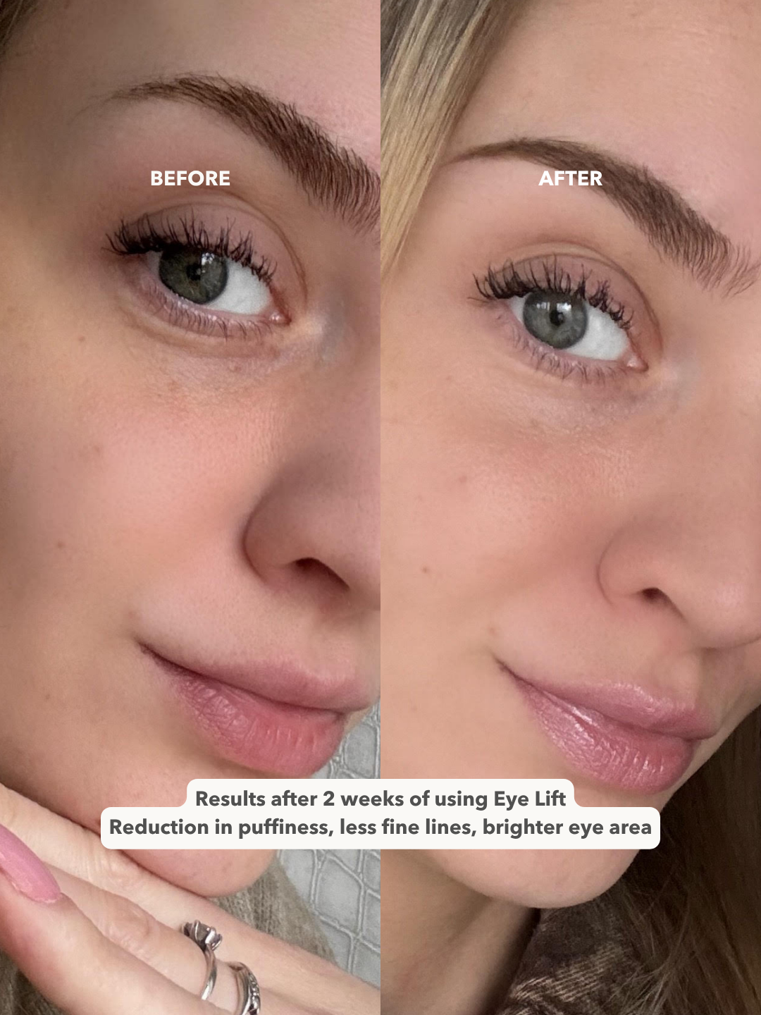 EYE LIFT™ - Firming and Smoothing Eye Cream