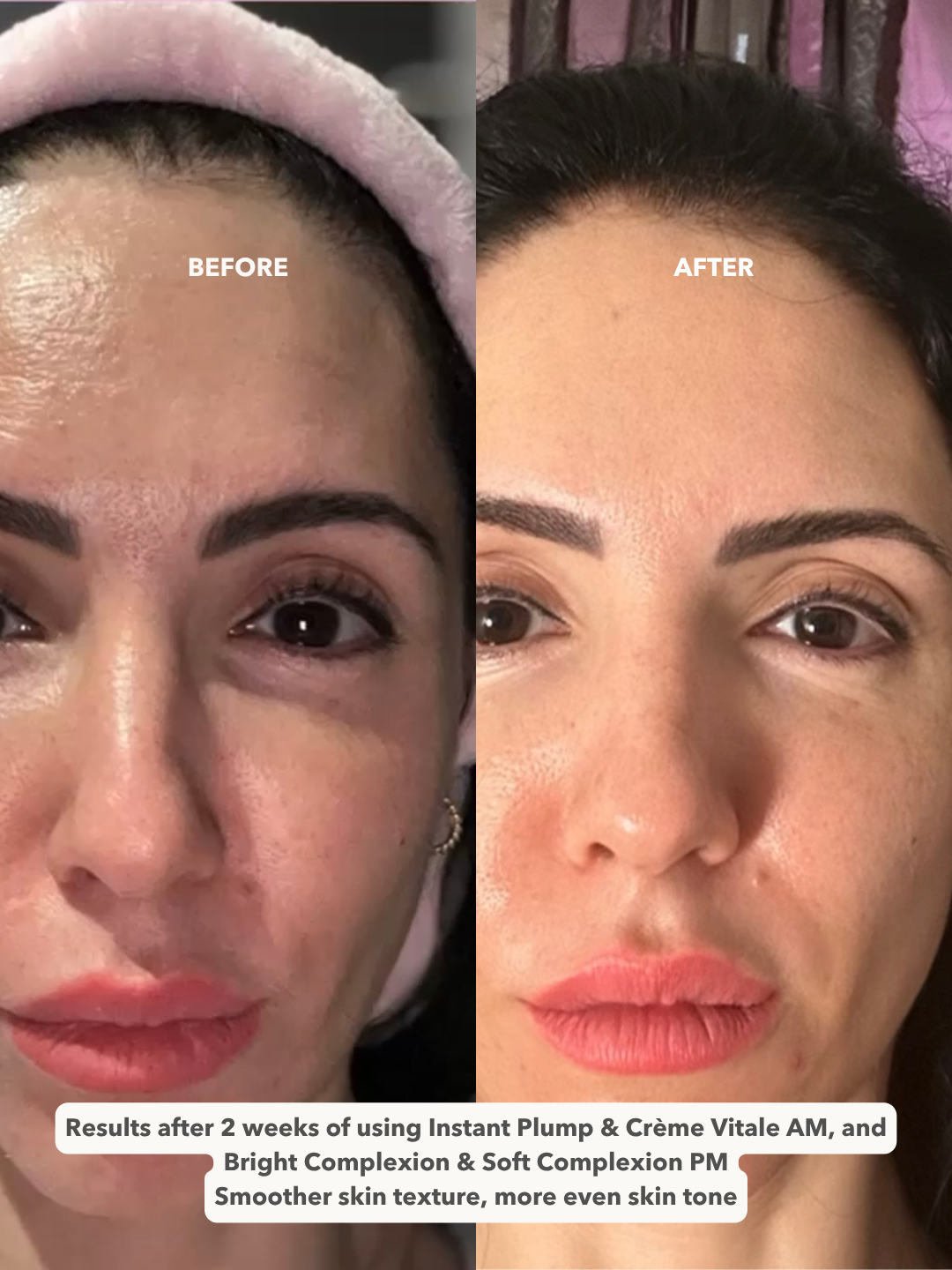 CRÈME VITALE™ - Ultimate Revitalizing Day Cream