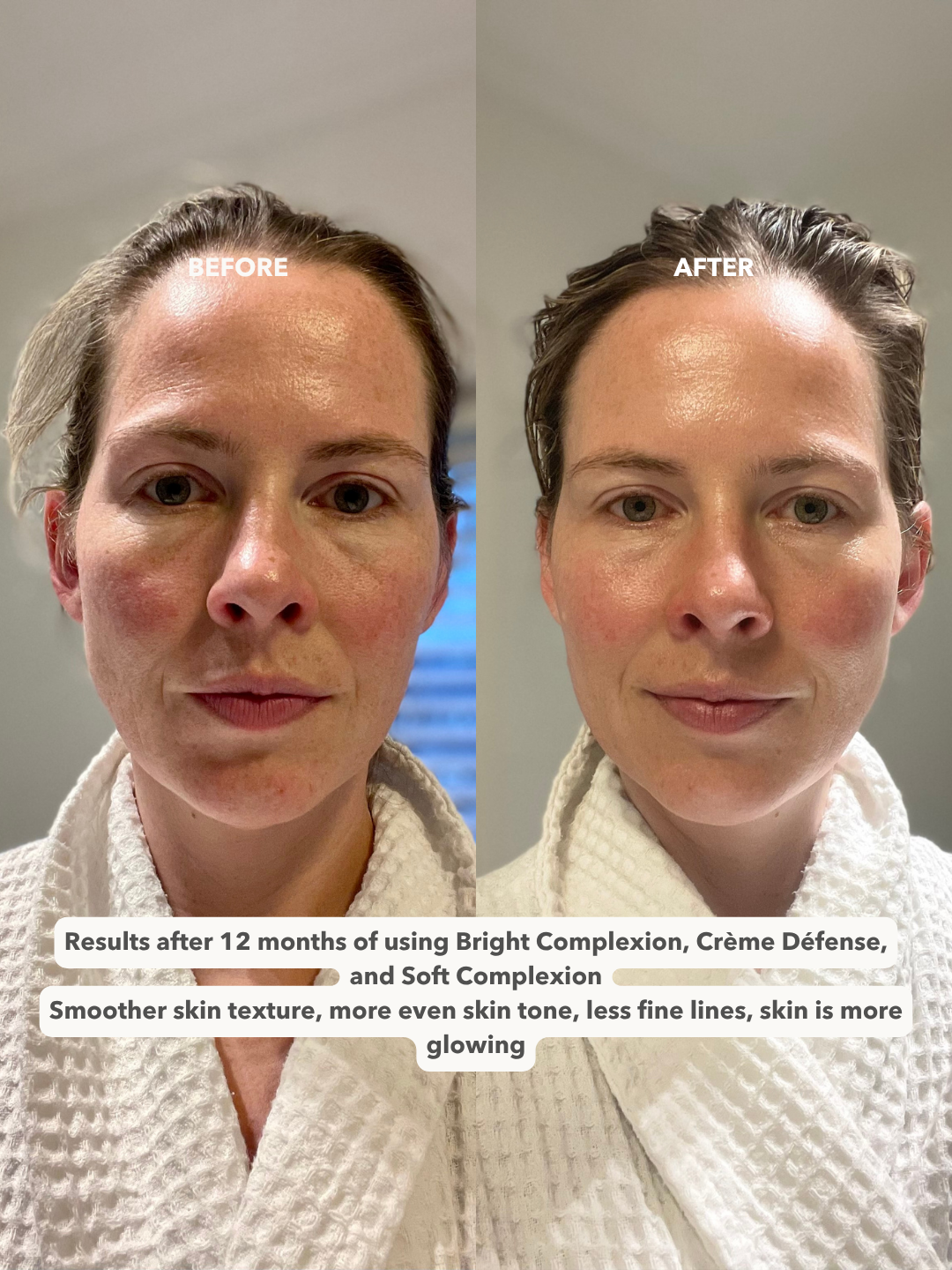 CRÈME DÉFENSE™ - Age Protective Day Cream + UV-A