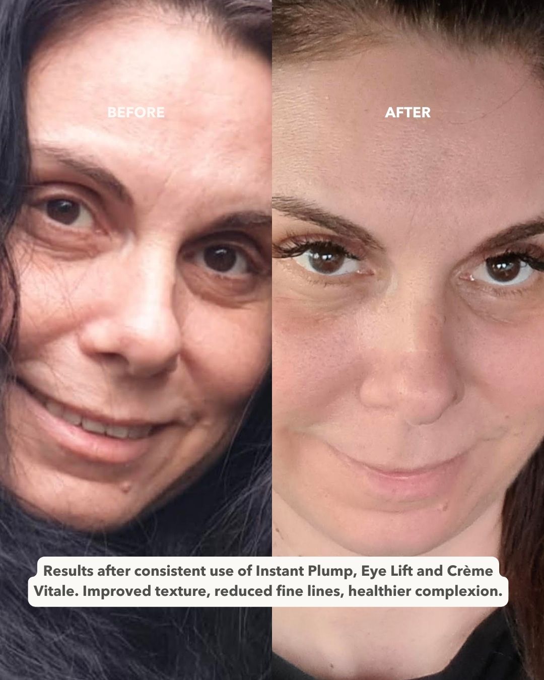 EYE LIFT™ - Firming and Smoothing Eye Cream